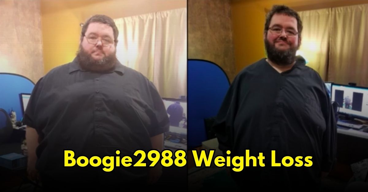 Boogie2988 Weight Loss Surgery